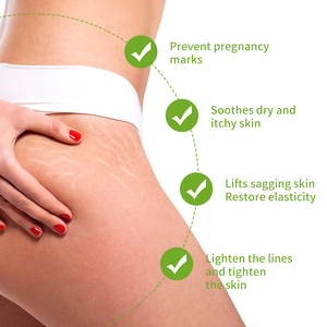 プライベートブランド ハーブ産後ストレッチマーク除去クリーム しわ対策 肌修復 傷跡除去 妊娠線クリーム 全身用 - Product Image 4