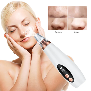 Limpiador con Carga Inalámbrica y Tecnología de Adsorción al Vacío: Dile Adiós a los Problemas de Nariz de Vainilla - Product Image 3