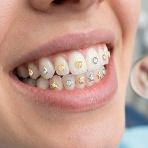 Gioielli Dentali Personalizzati Lotus in Oro Massiccio 14k con Diamanti e Cristalli, Gioielli Hip Hop per Denti - Product Image 5