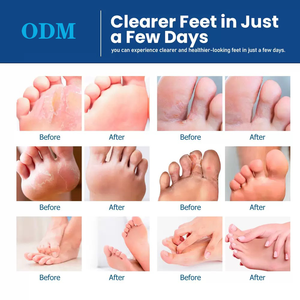 Krim anti jamur multifungsi untuk wanita, krim pereda kulit gatal kaki atlet Ringworm dengan ekstrak Herbal Lavender - Product Image 4