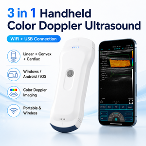 Sonda USB WiFi 3 en 1 para Uso Veterinario Clínico, Ecógrafo <span class=keywords><strong>Doppler</strong></span> Color Portátil - Product Image 6