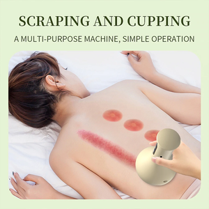 <span class=keywords><strong>Ventouse</strong></span> électrique masseur corporel sous vide lumière rouge chauffage combustion des graisses Guasha <span class=keywords><strong>Cellulite</strong></span> 9 niveaux Massage par inhalation - Product Image 5