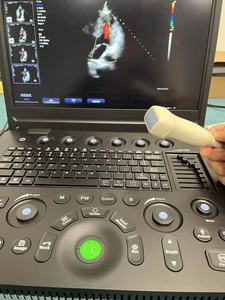 Ecógrafo Doppler Color Portátil Profesional 4D <span class=keywords><strong>5D</strong></span> con Pantalla de 15.6 Pulgadas, Sistema de Diagnóstico Cardíaco, Obstétrico y Ginecológico - Product Image 2