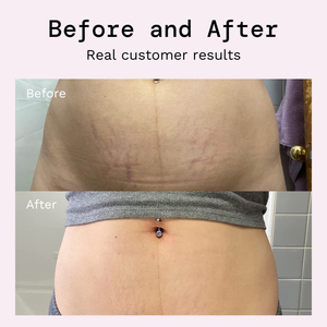 Creme Corporal de Marca Própria com Retinol, Vitamina E e Colágeno para Remoção de Cicatrizes de Acne e Estrias, Clareamento da Pele e Antienvelhecimento - Product Image 3