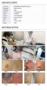 Laser Remission Long Pulse <strong>Tatoo</strong> Medical 755nm/1064nm 532nm Laser Picosecond Skin Resurfacing Ndyag Laser <strong>Machine</strong> - Product Image 5
