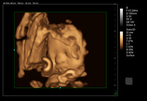 Mesin Ultrasound portabel medis dengan sistem Doppler warna untuk penggunaan manusia - Product Image 5