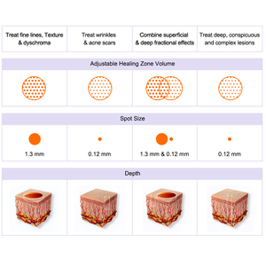 เลเซอร์กำจัดเศษ CO2เพื่อความงามแบบพกพา<span class=keywords><strong>4D</strong></span> ดูแลผิวมืออาชีพ - Product Image 5