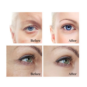 Crème <span class=keywords><strong>pour</strong></span> les yeux raffermissante et revitalisante QBEKA, lissante, raffermissante, anti-âge, réduit les ridules, les <span class=keywords><strong>cernes</strong></span> - Product Image 5