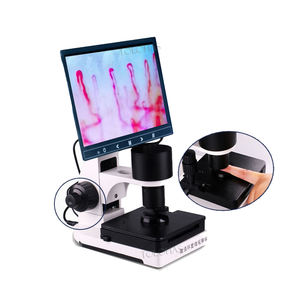LHBXW880 <span class=keywords><strong>Microcirculation</strong></span> capillaire pour les ongles d'hôpital Prix Microscope Instrument de <span class=keywords><strong>test</strong></span> de santé corporelle - Product Image 3