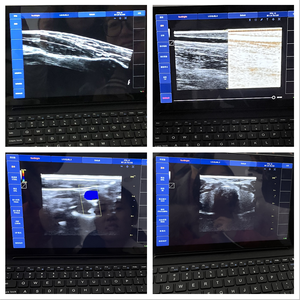 Nueva llegada Color Doppler gratis portátil Veasi <span class=keywords><strong>Scan</strong></span> portátil ultrasonido Color Doppler máquina USB ultrasonido sonda convexa - Product Image 3