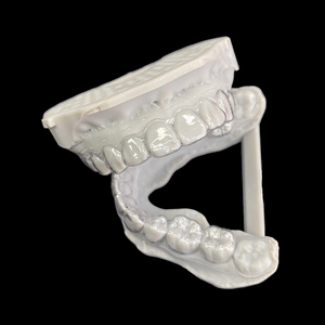 Retainer orthodontique personnalisé pour l'extérieur de laboratoire dentaire – Compatible STL ou modèle dentaire pour laboratoire dentaire (types Hawley, Clear, <span class=keywords><strong>Essix</strong></span>) - Product Image 1