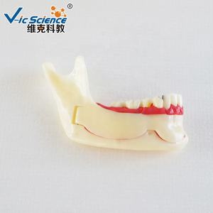 Modelo Dental Anatómico de Dientes Posteriores Inferiores Derechos en Resina y PVC para Educación en Ciencias Médicas en Escuelas y Hospitales - Product Image 5