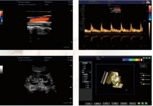 Ecógrafo Doppler Color Portátil GCT-76S, Escáner Médico Hospitalario para Exámenes de Abdomen, Obstetricia/Ginecología, Cardiología y Vascular - Product Image 5