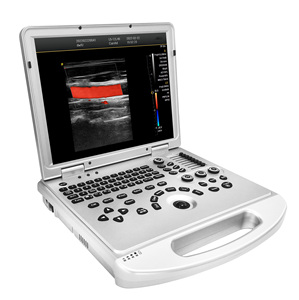 Ecógrafo Doppler Color Portátil de Alto Rendimiento Dawei DW-L3, Diseño Tipo Laptop para Diagnóstico en Hospitales Primarios - Product Image 4