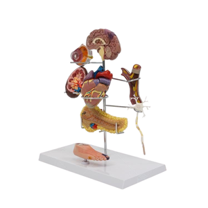Modelo de Enseñanza Médica, Modelo de Diabetes para Educación en Endocrinología y Fisiopatología - Product Image 5