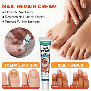 Tratamiento/Farmacíacos para Hongos en las Uñas Kanyehb, Pasta para Eliminar el Gris, Comercio Exterior Transfronterizo, Temu, <span class=keywords><strong>Shein</strong></span> - Product Image 5