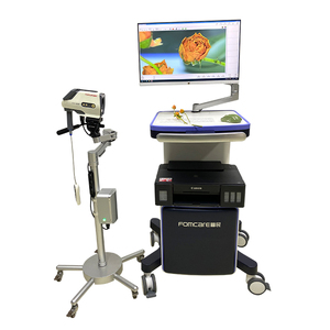 Colposcopio de Video para Examen Ginecológico C6HD de Alta Calidad, Endoscopio Vaginal, Colposcopio Ginecológico - Product Image 6