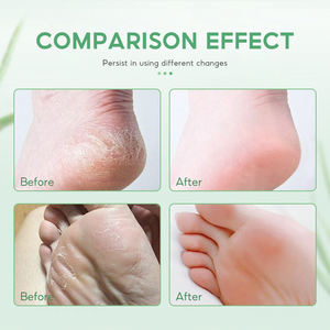 OOT Cson roductos 30ml Concentrados ooot pair epair reream reo Extremely ry raceted Feet stantly oosts oioisture evevels - Product Image 3