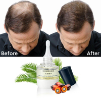 Essence capillaire 100% naturelle et biologique pour le cuir chevelu, anti-érogulation des follicules pileux, améliore la santé du cuir chevelu, soin des cheveux contre la chute des cheveux, inhibe la DHT, sérum pour le cuir chevelu