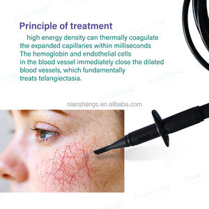 Mascarilla de belleza de plástico para eliminación vascular con tecnología de hilo de termocoagulación, barra RBS para eliminación de venas de araña rojas para uso en salón - Product Image 6