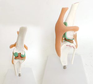 Hunde kniegelenk modell Stadien des Osteoporose modells für Hunde - Product Image 2