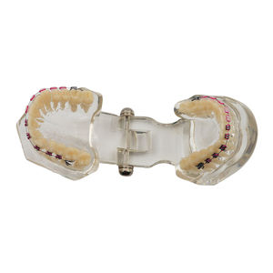 Modelo de Estudio de Ortodoncia Dental, Juego de 28 Dientes, Soportes Metálicos y de Cerámica, Resina para Demostración de Enseñanza - Product Image 5