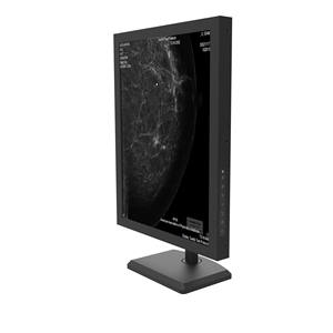 OEM 의료 3MP 그레이 스케일 유방 조영술 진단 디스플레이 LCD 모니터 - Product Image 4