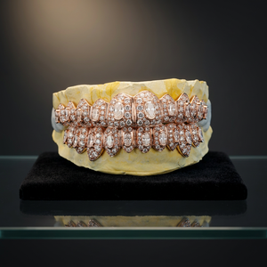 Juego de Grillz de Lujo en Oro Rosa con Incrustaciones Brillantes, Corte Micro, Joyería Dental, Rodio Negro, Estilo Hip Hop - Product Image 1