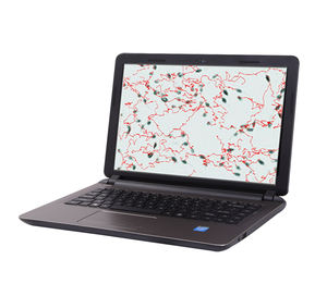 Système portable d'analyse de la qualité du sperme vétérinaire Refine <span class=keywords><strong>Medical</strong></span> RF-PL-6800P pour l'élevage animal - Product Image 2