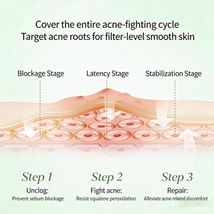 ครีมรักษาสิว<span class=keywords><strong>อักเสบ</strong></span> ลดรอยสิวและสิว<span class=keywords><strong>อักเสบ</strong></span> เซรั่มรักษาสิว<span class=keywords><strong>อักเสบ</strong></span>ที่ดีที่สุด ชุดผลิตภัณฑ์ดูแลผิว 3 ชิ้น - Product Image 4