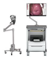 Système de caméra vidéo colposcopique portable IKEDA monté sur chariot avec éclairage LED intégré et stockage sur carte SD 32 Go pour la gynécologie
