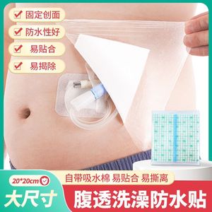 Patch médical imperméable Ou Mei, 20 cm x 20 cm, film protecteur de grande taille pour la couverture des plaies, utilisation postopératoire - Product Image 3