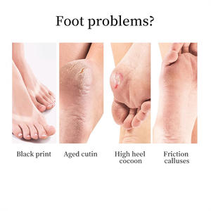 Crema de Beriberi de aceite esencial transfronterizo para <span class=keywords><strong>pies</strong></span> secos con picazón antipruriginoso Exfoliante para el cuidado de los <span class=keywords><strong>pies</strong></span> desodorante <span class=keywords><strong>hongos</strong></span> hidratantes - Product Image 4