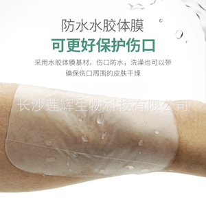 Apósito hidrocoloide médico Lianhui de 10 cm x 10 cm transparente para el rostro, parches para el acné de un solo uso - Product Image 3