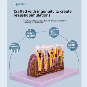 4X modèle de développement de caries dentaires en PVC agrandi pour l'éducation des patients et l'outil de formation dentaire - Product Image 6