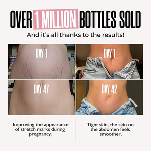 Chống vết rạn da làm săn chắc bụng căng đánh dấu loại bỏ Shea bơ kem dưỡng da dưỡng ẩm Kem massage cho dạ dày mờ dần vết sẹo - Product Image 6