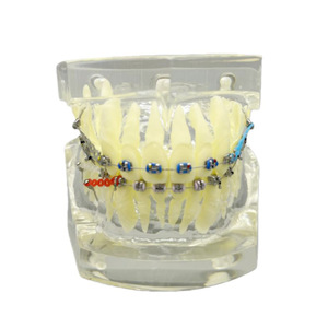 โมเดลการสาธิตการจัดฟันพร้อมสายรัดและแถบยางสำหรับคลินิกทันตกรรมและการสื่อสารกับผู้ป่วย - Product Image 4