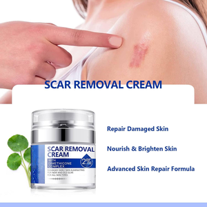 ครีมลบ<span class=keywords><strong>รอย</strong></span>แผลเป็น |   มีประสิทธิภาพสำหรับการผ่าตัด, <span class=keywords><strong>สิว</strong></span>, <span class=keywords><strong>รอย</strong></span>แผลผ่าคลอด |   ใช้ได้กับรอยแผลเป็นทั้งเก่าและใหม่ |   ทุกสภาพผิว ไม่มีน้ำหอม 60 กรัม - Product Image 3