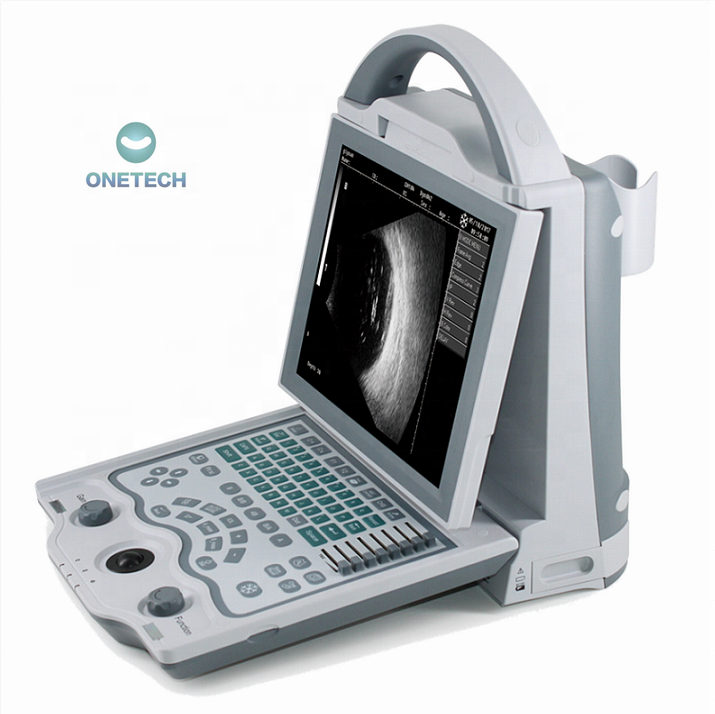 Good Price High Precision AB Scan Ophthalmic Ultrasound Vision ultra Sound with USA Probe