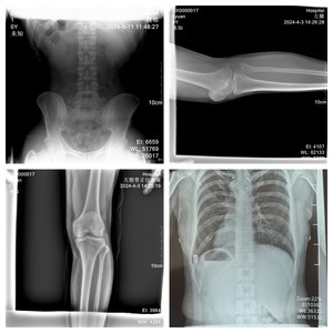 AIB modèle 4343 <span class=keywords><strong>appareil</strong></span> à rayons X Portable 43*43cm détecteur à écran plat numérique <span class=keywords><strong>radiographie</strong></span> médicale sans fil - Product Image 4