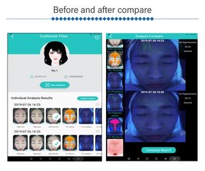 Korea Professional Gesichtshaut analyze gerät Digitaler Hauts canner <span class=keywords><strong>Test</strong></span> analyze gerät Gesichtshaut analysator - Product Image 5