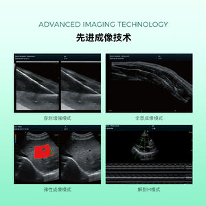 Appareil d'échographie Doppler couleur pour animaux de compagnie Promax, écran 21 pouces, imagerie haute définition, Revo T1 VET, équipement de diagnostic vétérinaire - Product Image 1