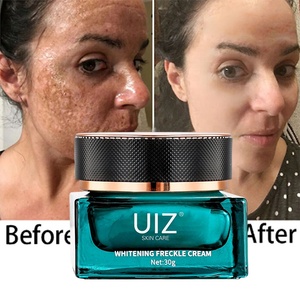 Niacinamide Zoethout Whitening Cream Donkere Vlek Verwijdering Voor Hyperpigmentatie Melasma Melanine Met Vitamine E Hyaluronzuur - Product Image 3