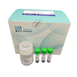 Kit Gel SDS-PAGE Siap Pakai |   Sistem Elektroforesis Gel Protein Pracetak - Product Image 1