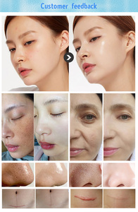 Multifunctional Bubble Remove Black Head <b>Oxygen</b> Hydro Dermabrasion Facial Cleaning Beauty <b>Machine</b> - Product Image 5