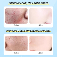 Sérum Visage Anti-Acné et Éliminateur de Cicatrices d'Acné, Régulateur de Sébum, Meilleur Sérum à l'Acide Salicylique pour Boutons