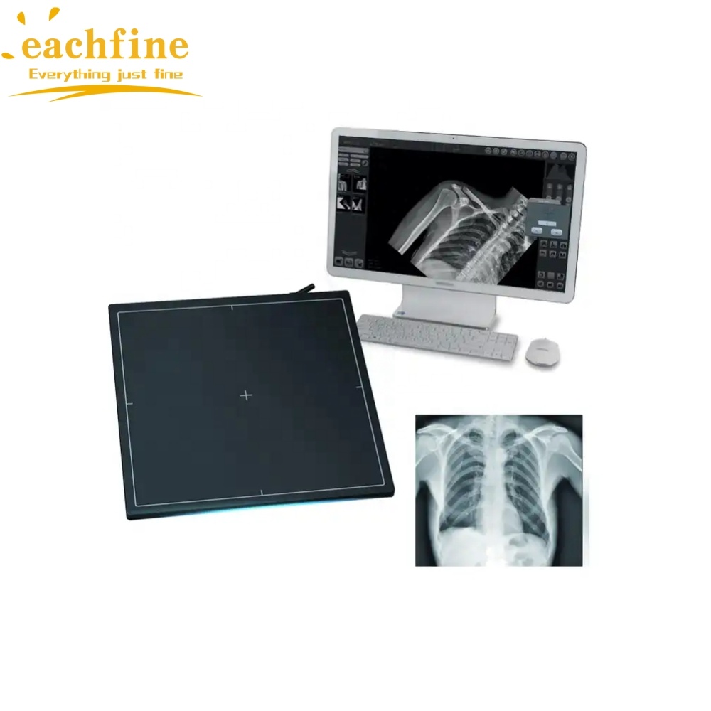 Wholesale Price Veterinary Xray 14 * 17 Inch Wireless Flat Panel DR Detector X Ray Wireless DR Digital X-ray Flat Detector Panel