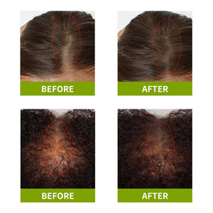 Grosir Label pribadi minyak rambut Rosemary organik terbaik perawatan kulit kepala alami untuk penumbuh ulang rambut cepat dan perbaikan untuk uniseks - Product Image 5