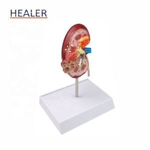 Modelo anatómico de riñón humano, modelo de piedra <span class=keywords><strong>renal</strong></span> de patología <span class=keywords><strong>renal</strong></span> de ciencia médica de PVC para uso escolar - Product Image 3