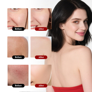 Bán buôn hữu cơ không mùi mỡ động vật Kem cơ thể bơ kem dưỡng da hấp thụ nhanh Kem dưỡng ẩm Whipped Thịt Bò mỡ động vật mật ong dưỡng cho da - Product Image 6